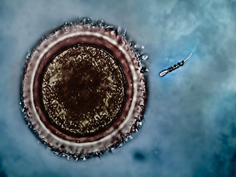 Espermatozoide con motor