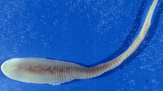 Espermatozoide