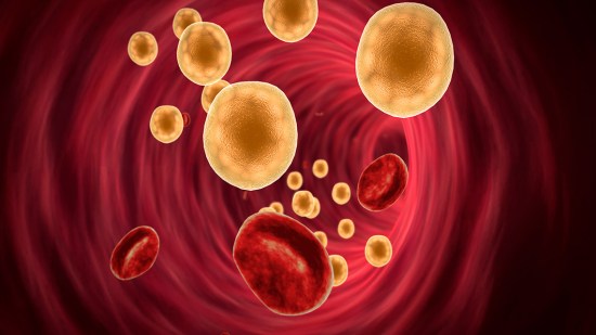 grasa en sangre