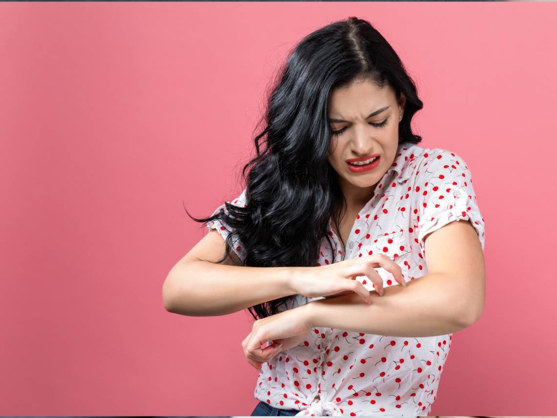 Mujer rascándose el brazo