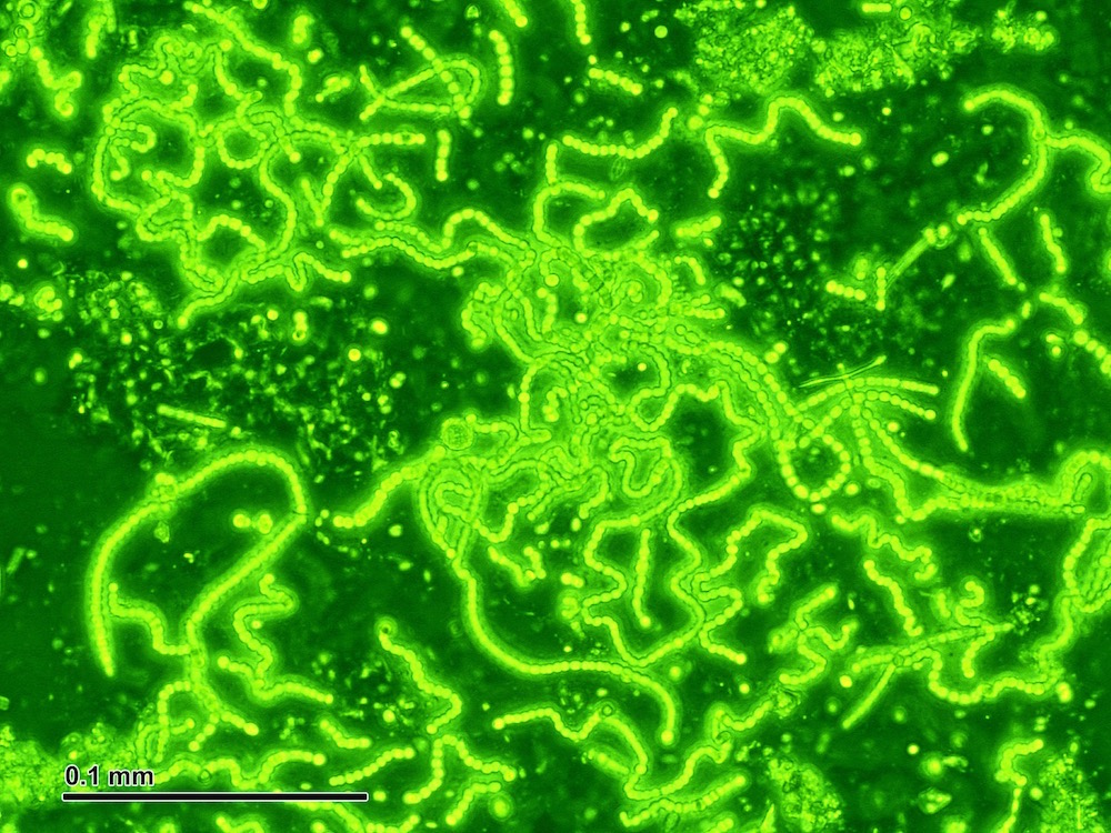 Cianobacterias