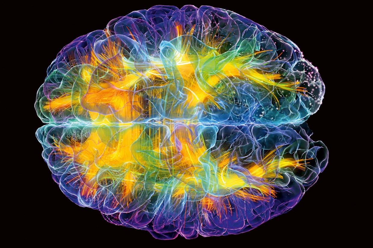 Cerebro