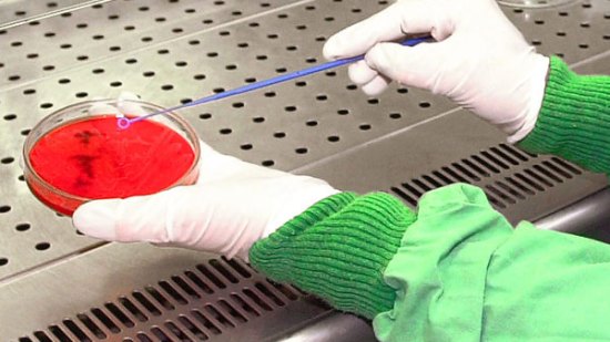 Las placas petri, el gran invento de la microbiología