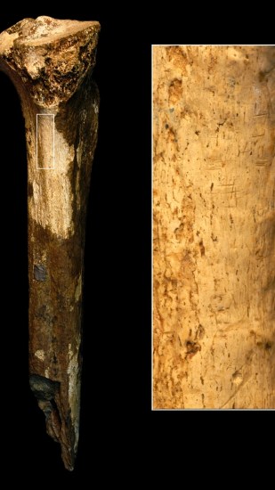 Tibia