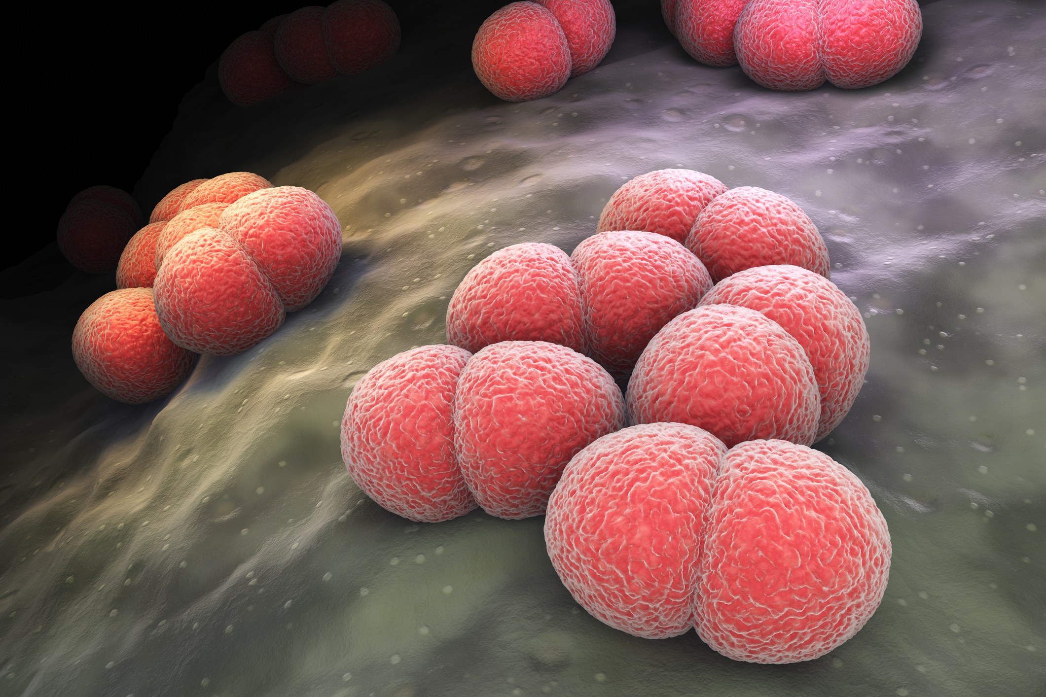 Meningitis bacteriana