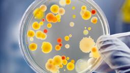 Bacterias en placa de Petri