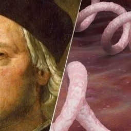 ¿Quién fue el primer autista de la historia?