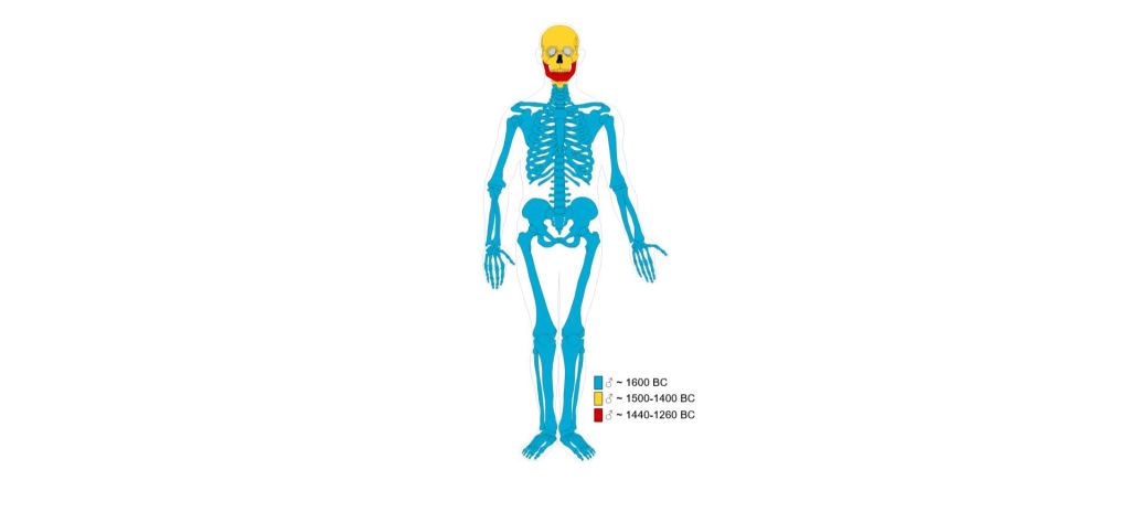 Cadáver compuesto de Clad Hallan