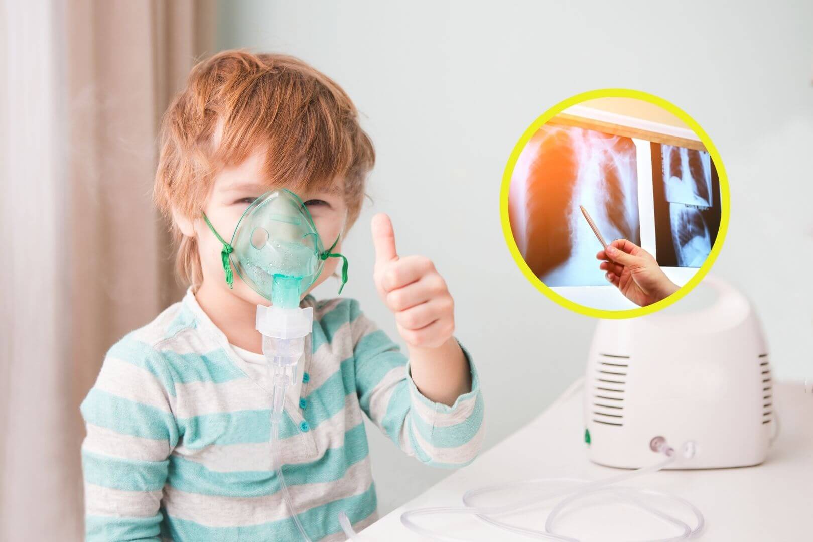 Prueban nuevo tratamiento inhalable para la fibrosis quística