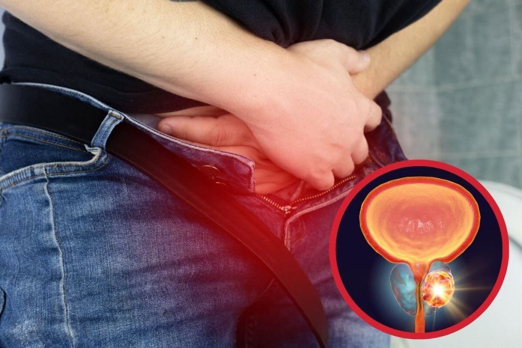 Diagnóstico más rápido y accesible del cáncer de próstata