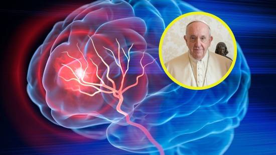 El papa falleció a causa de un ictus y un fallo cardíaco irreversible, según informó el médico del Vaticano