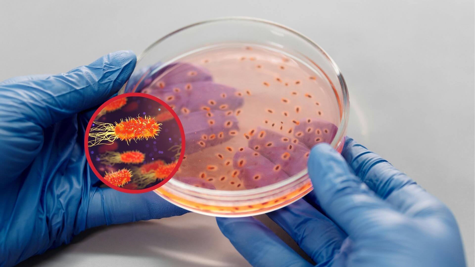 Bacterias que hablan sin palabras ¿cómo usan los microbios la física para comunicarse? 