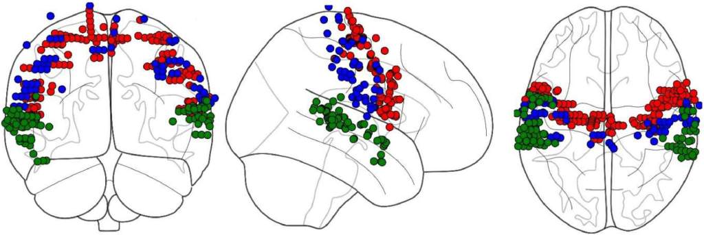 Gráfico de cerebro del estudio