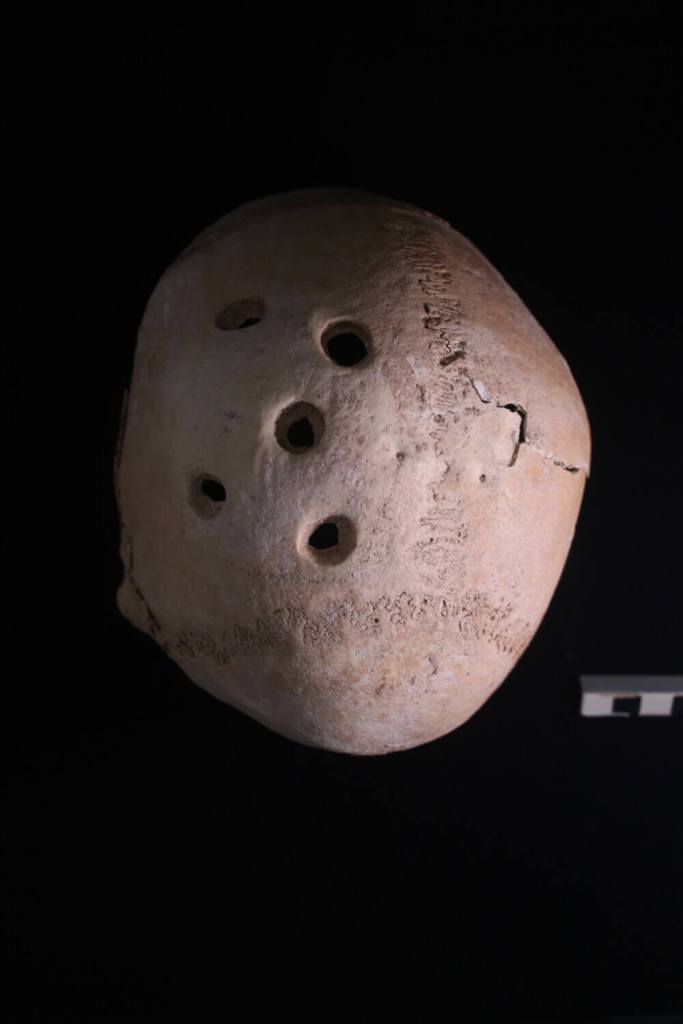 Imágenes del cráneo menorquín del Barranc d’Algendar: Cinco trepanaciones realizadas en momentos distintos. Unas antes de morir el individuo, y otras después (Créditos: C. Sobrado y E. Camarós, USC).