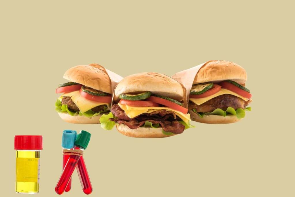 comida chatarra