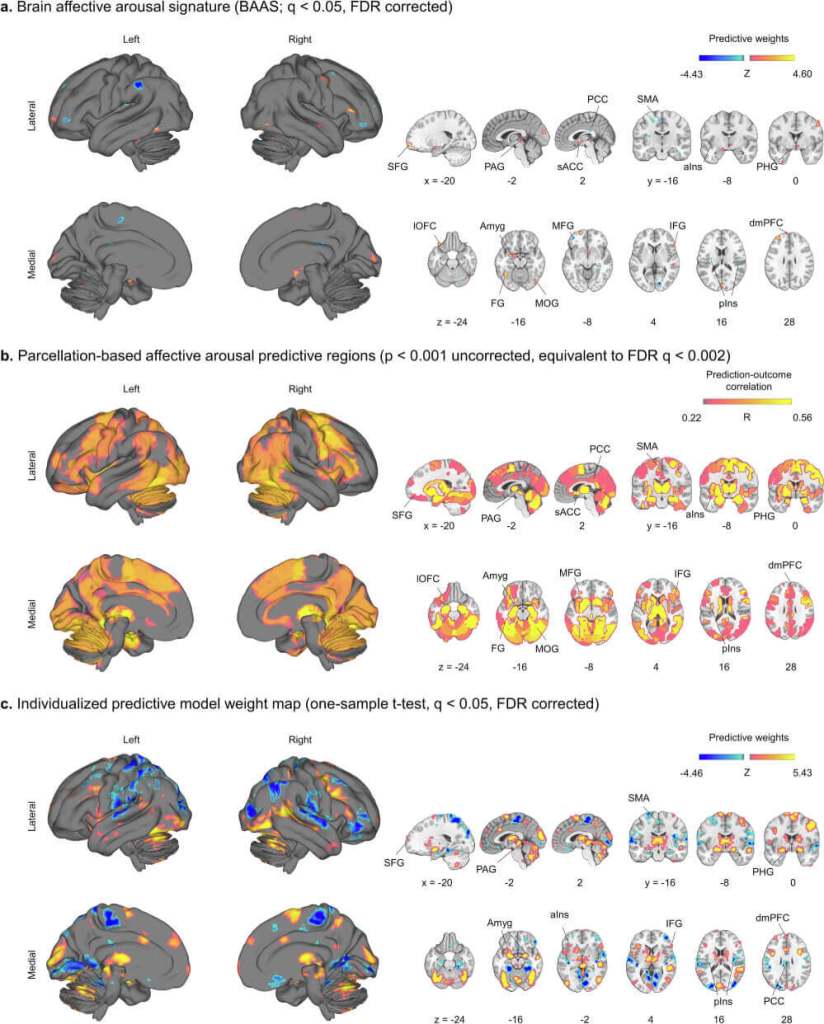 Gráfico estudio cerebro