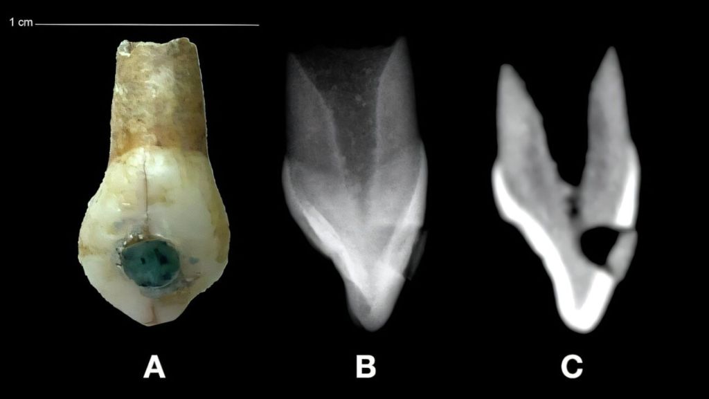 Pieza dental con incrustación de jade, maya