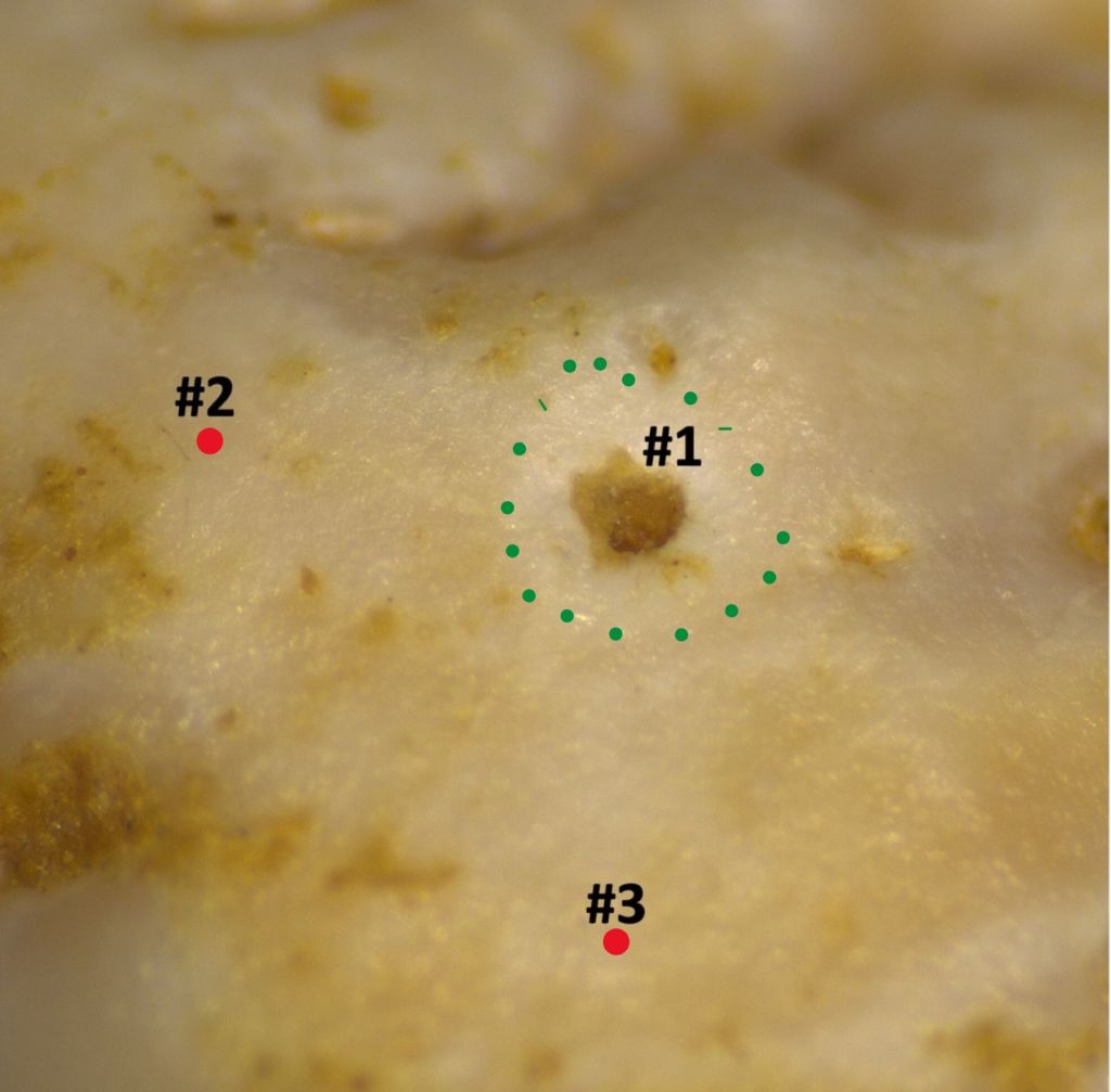 Caries neandertal