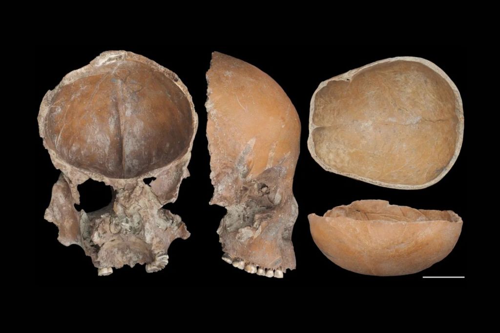 Cráneo humano modificado con forma similar a una máscara facial
